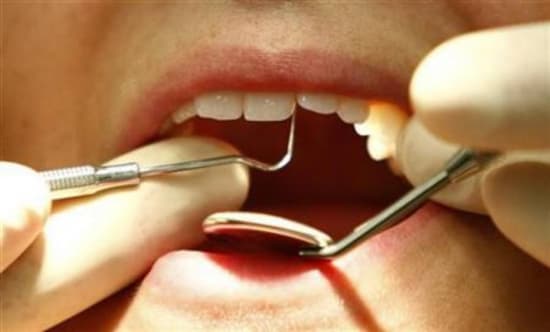 ALÍVIO? Pesquisadores criam nanopartícula para substituir o ‘motorzinho' em tratamento de cárie