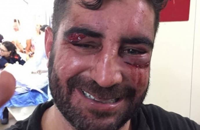 FOTO: Em Brasília, filho do presidente do senado, Renan Calheiros, envolvido em briga