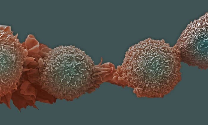 Cientistas espanhóis removem a ‘imortalidade’ das células de câncer