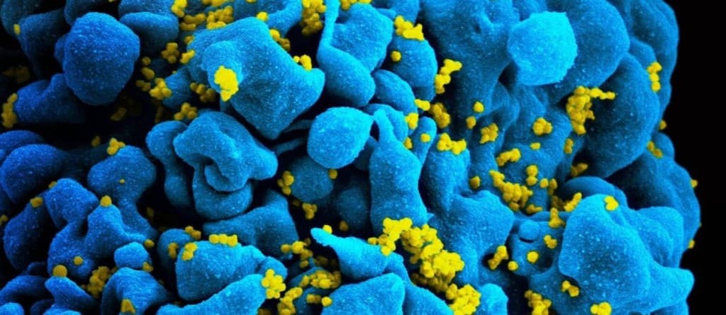 Há 12 anos jovem com HIV não toma remédio e não tem sintomas da doença
