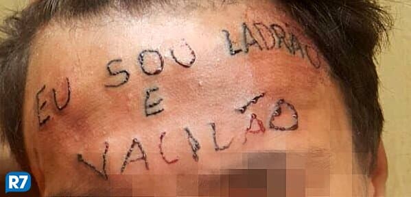 Adolescente que teve testa tatuada "eu sou ladrão e vacilão" passa por segunda fase de remoção