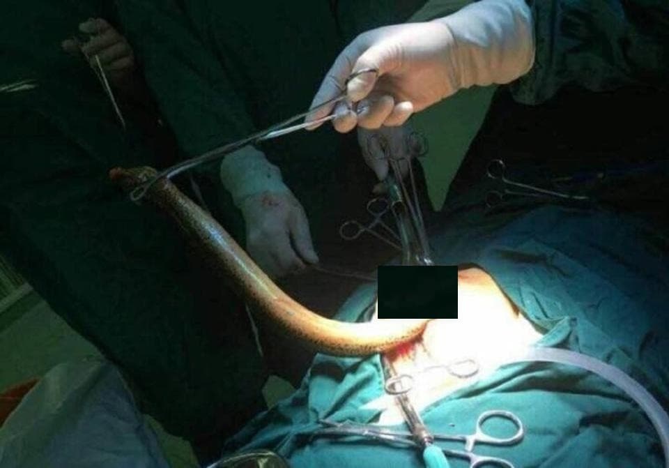 FOTOS: Vlogueira que introduziu enguia viva na vagina é presa