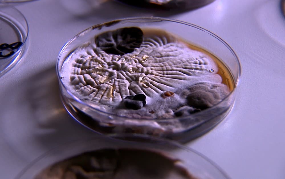 Estudo identifica 23 mil fungos e bactérias em celulares; risco vai de micoses até infecções respiratórias