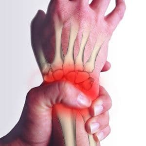 Sesap alerta para necessidade de prevenção a LER/DORT; veja sintomas e tratamento