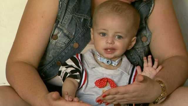 Bebê é internado com pneumonia e tem pé e dedos das mãos amputados