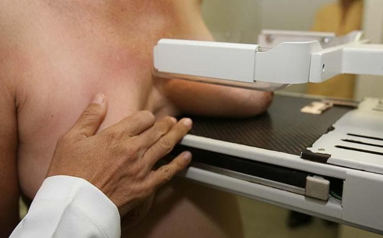 UFRN abre inscrições para mutirão de mamografias