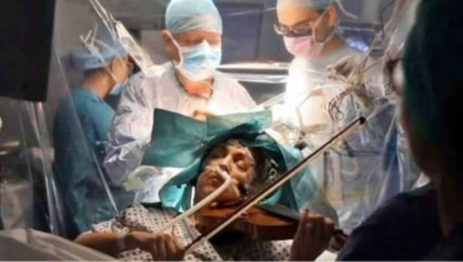 FOTO: Mulher toca violino durante cirurgia em seu cérebro