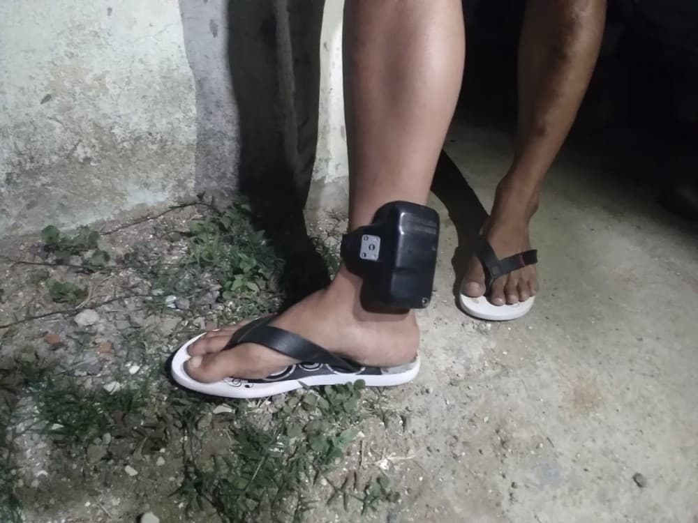 CGU constata superfaturamento de R$ 6 milhões em locação de bodyscans e tornozeleiras no RN