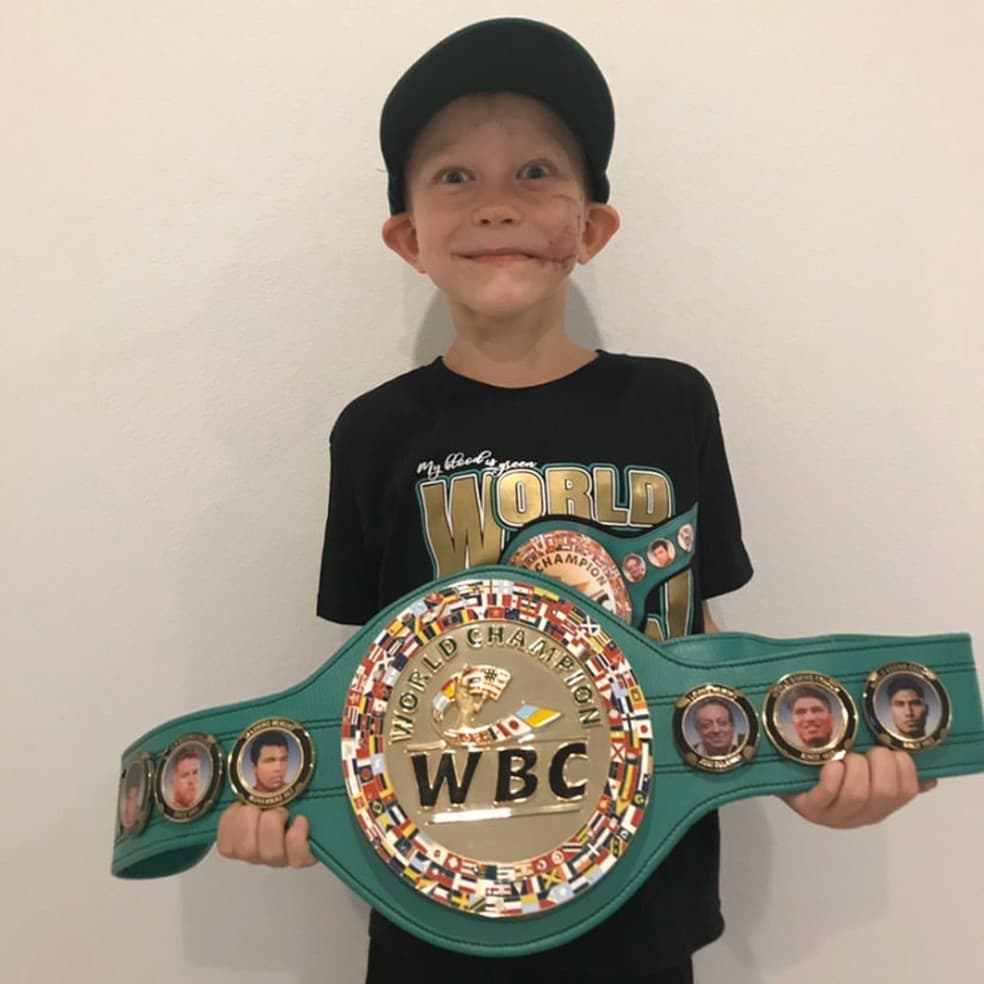 FOTO: Menino que ficou desfigurado após salvar a irmã recebe cinturão do Conselho Mundial de Boxe