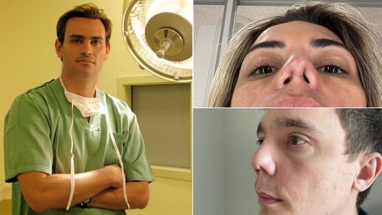ABSURDO: Einstein, Sírio-Libanês e São Luiz afastam cirurgião acusado de deformar narizes de mais de 30 pacientes