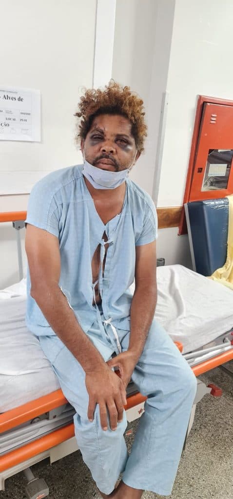 FOTOS: Veja como ficou o morador de rua espancado por personal após flagrar traição