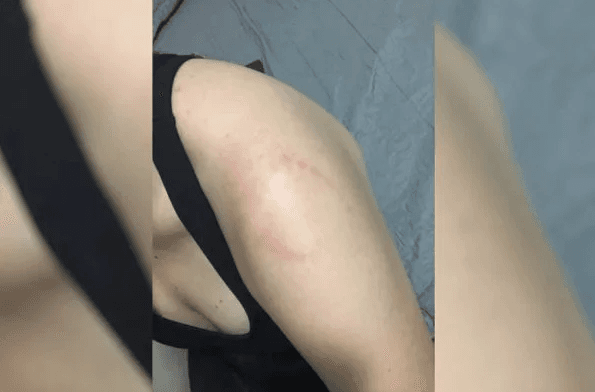 VÍDEO: Mulher leva mordida após esbarrar em homem na academia