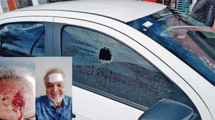 Secretário Adjunto de Guamaré sofre tiro de raspão na cabeça em tentativa de assalto
