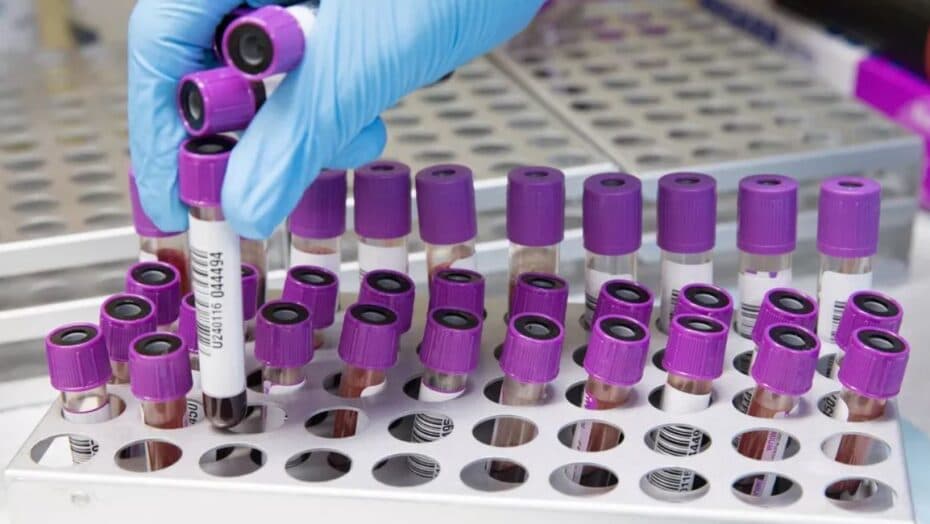 Saúde investiga seis mortes por suspeita de hepatite misteriosa em crianças e adolescentes