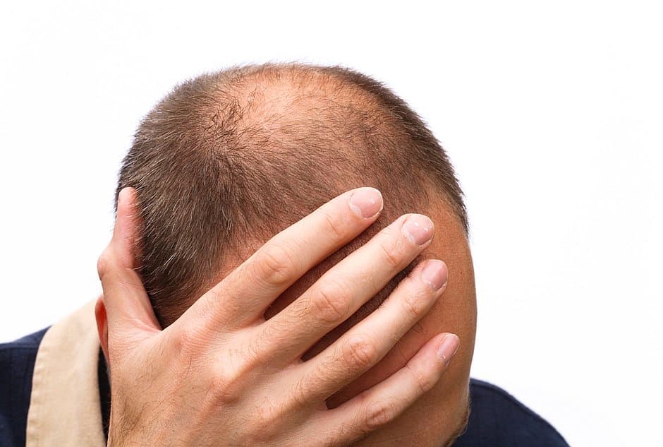 Chamar homem de ‘careca' é assédio sexual, decidem juízes ingleses