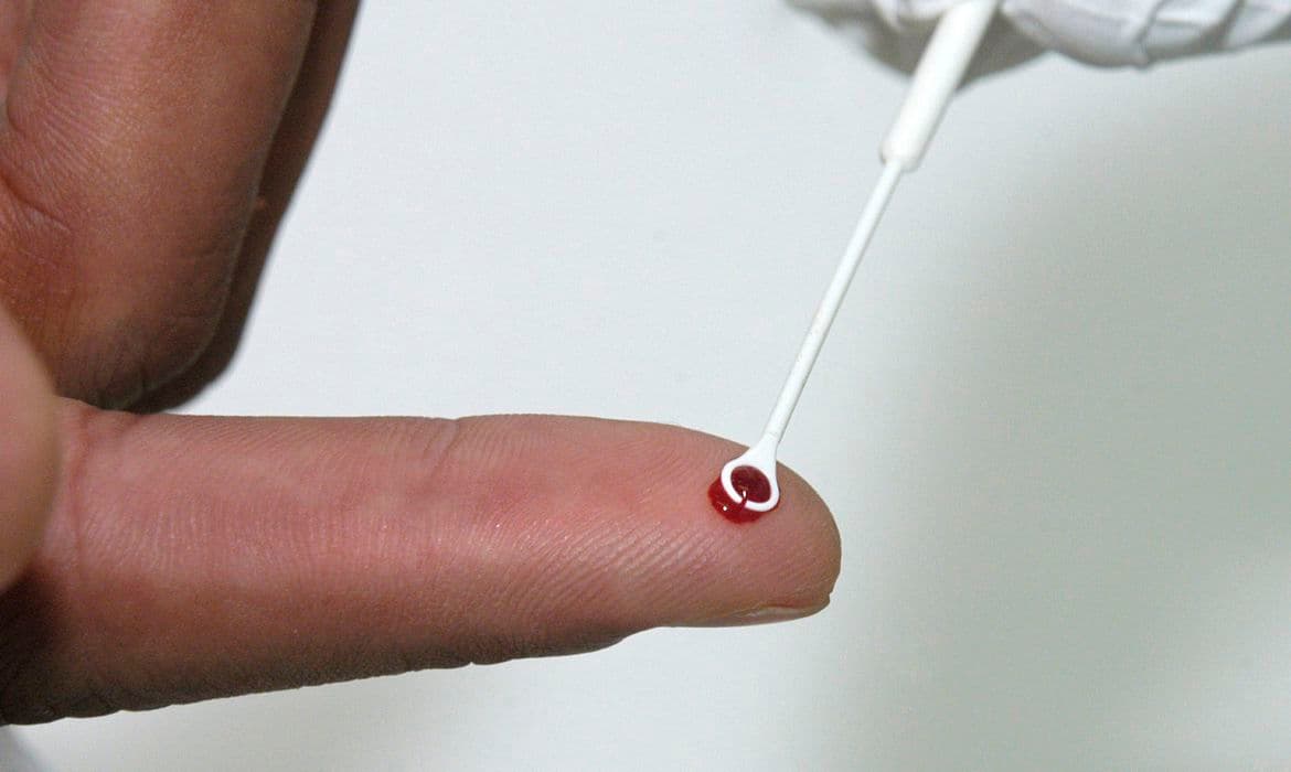 RN aumenta em 36,8% o número de casos de AIDS e em 28,8% taxa de infecções por HIV em uma década