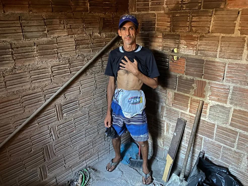 Paciente de Natal que improvisava sacola no lugar de bolsa de colostomia não está em fila para cirurgia por erro do município