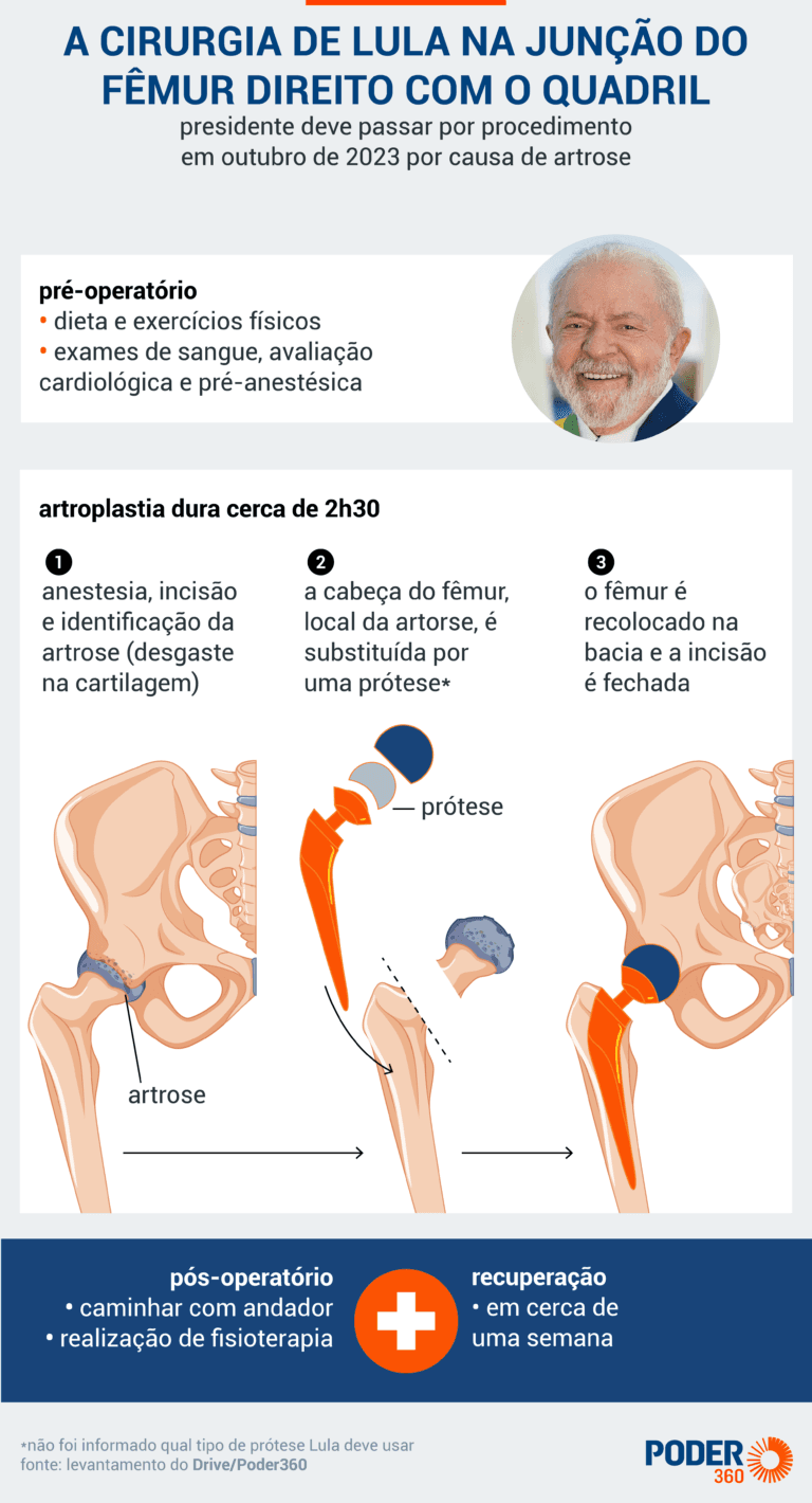 Lula deixa hospital após procedimento para reduzir dores no quadril