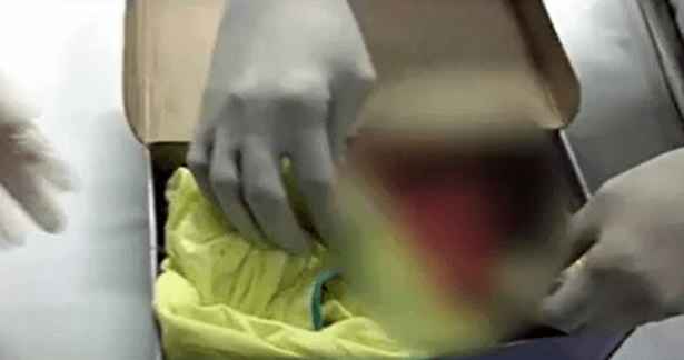 Morre bebê que foi abandonada em caixa de sapato há uma semana em São José de Mipibu