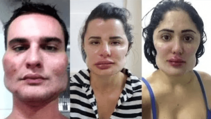 Médico é condenado à prisão após deformar o rosto de pelo menos nove pacientes