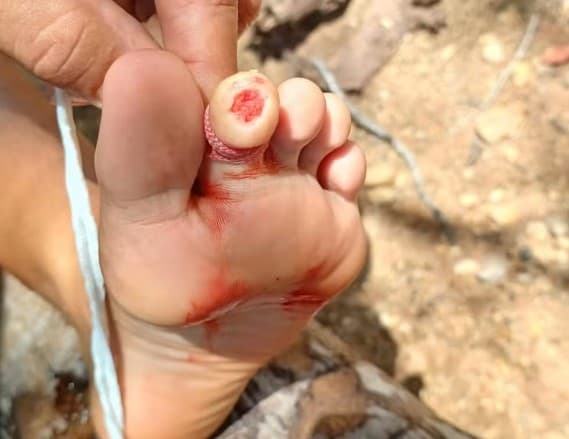 Piranhas atacam banhistas e prefeitura de Pendências recomenda que população evite o Rio Açu