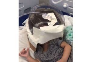 Bebê que recebeu embalagem de bolo como máscara improvisada tem alta da UTI