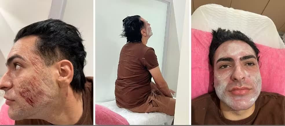 Laudo conclui que empresário morreu após inalar fenol durante procedimento