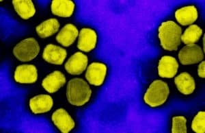 Mpox: restrições de viagens teriam ‘impacto desnecessário' nas economias, diz OMS