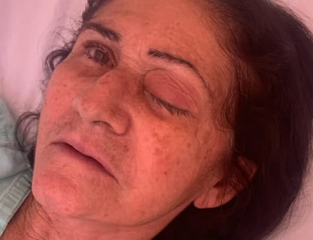 Pelo menos oito pessoas perdem olho após mutirão de cirurgia de catarata em Parelhas
