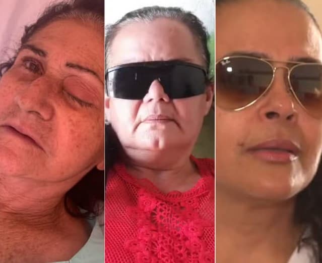 Pacientes infectados durante mutirão de catarata em Parelhas devem ser indenizados pela prefeitura, diz Ministério Público do RN