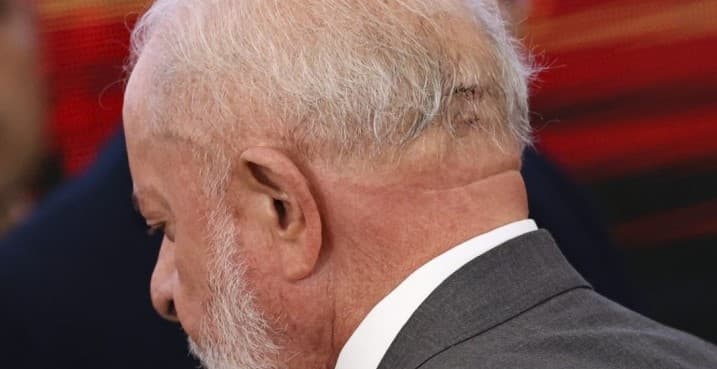 Procurador-geral da Venezuela pede investigação sobre queda de Lula e diz que presidente ‘manipulou' corte na cabeça