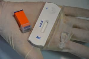 Número de pessoas com HIV aumenta 98% em dez anos no RN