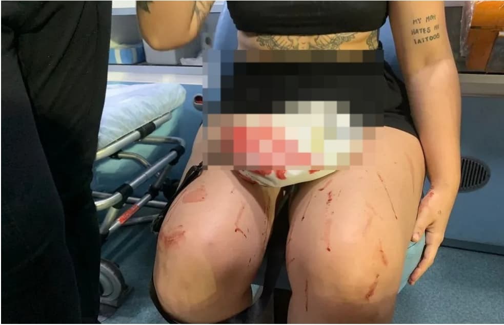 Mulher que agrediu outra na academia em Natal hoje (11) foi presa e responderá por lesão corporal grave