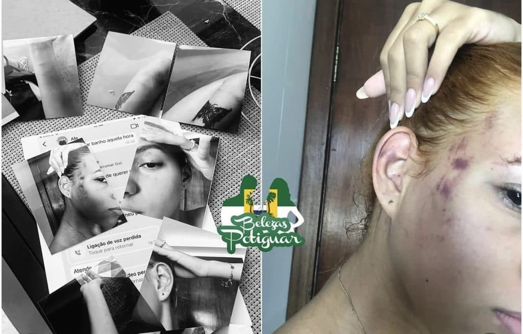 Dentista conhecido de Natal é denunciado pela ex-namorada por agressão física