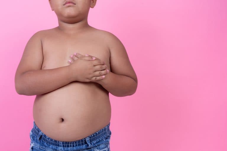 Índice de obesidade infantil no RN é superior às médias nacional e do Nordeste