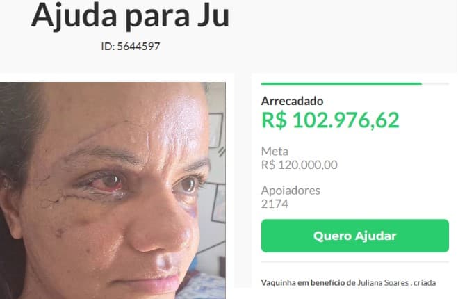 Vaquinha para tratamento de mulher agredida pelo namorado com 61 socos arrecada mais de R$ 100 mil