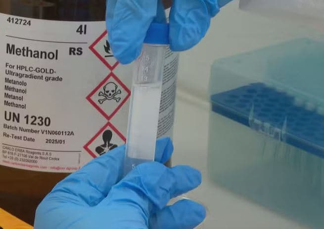 Surto de metanol no Brasil: 17 casos confirmados e 2 mortes após consumo de bebidas adulteradas; SP concentra a maioria