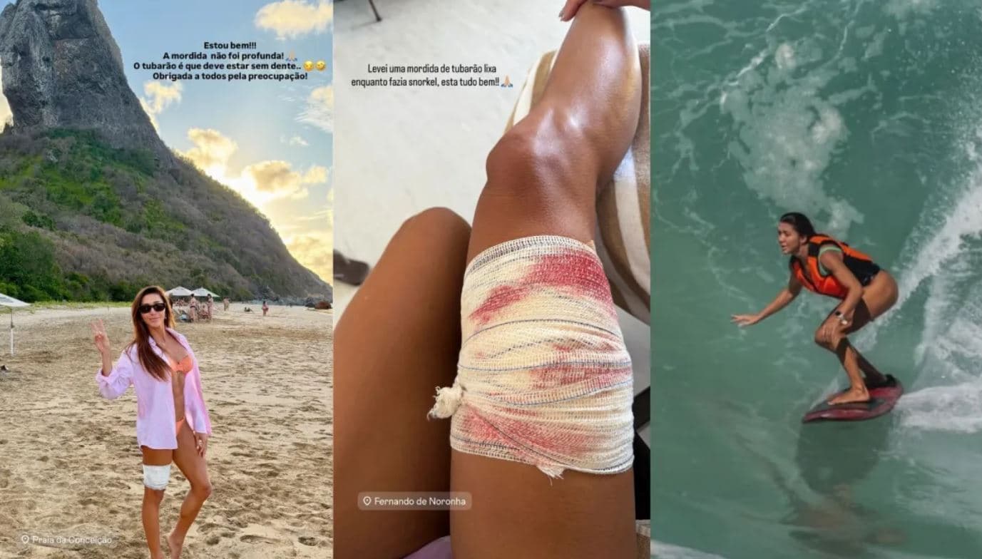 Turista é mordida por tubarão durante mergulho em Fernando de Noronha
