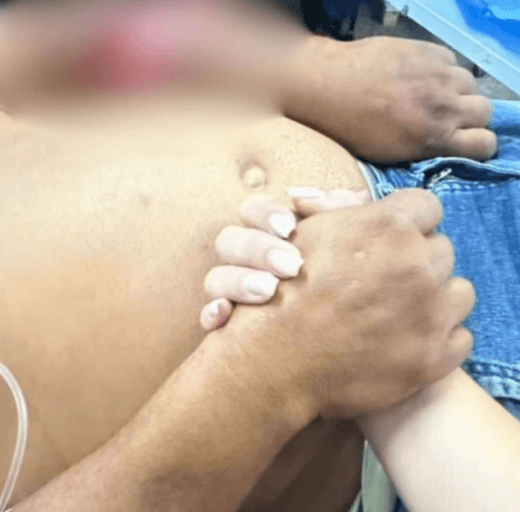 Homem é atacado pelo próprio pitbull no interior do RN e sofre corte profundo no antebraço