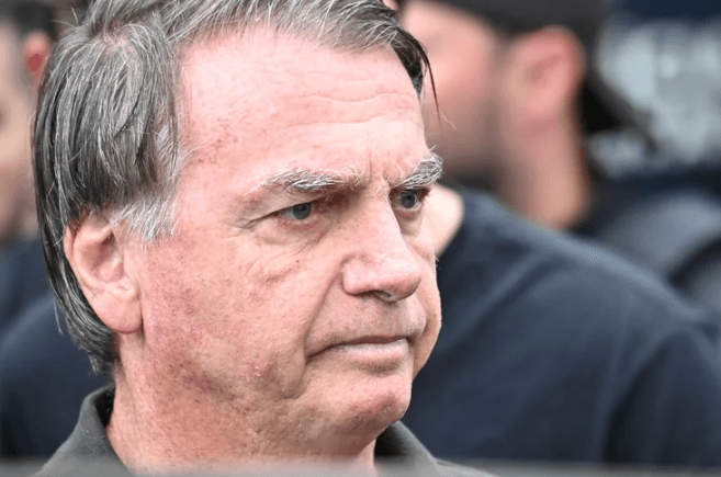 Bolsonaro sofreu ‘traumatismo leve' na cabeça e passará por avaliação clínica, diz Dr. Cláudio Birolini