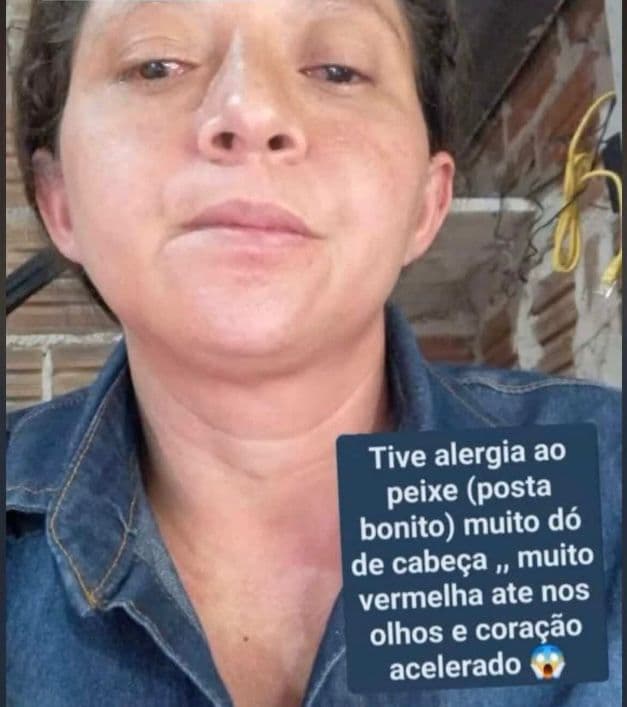 Peixe distribuído na Semana Santa causa mal-estar e leva moradores ao hospital em Angicos