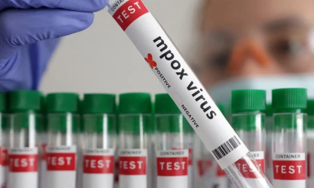 Mpox no RN chega a 12 casos e novos registros são confirmados pela Saúde