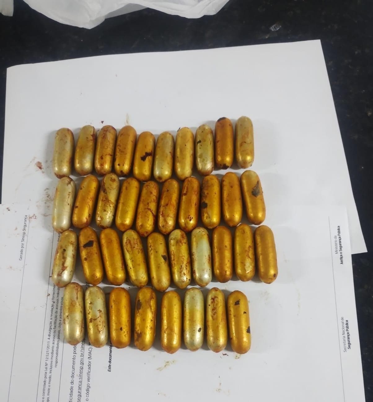 Homem engole 111 cápsulas de cocaína, expulsa 73 na Irlanda, volta a Natal com 38 e é preso após cirurgia no Walfredo