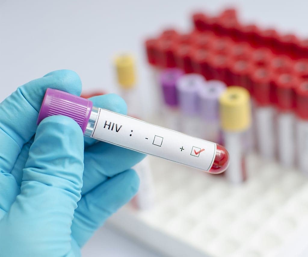 AINDA SEM CURA: Natal faz alerta para recorde de casos de AIDS em adultos