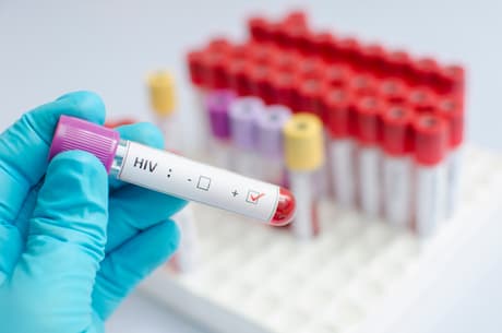 Homem de 44 anos pode ser o primeiro no mundo a ter se curado do vírus HIV