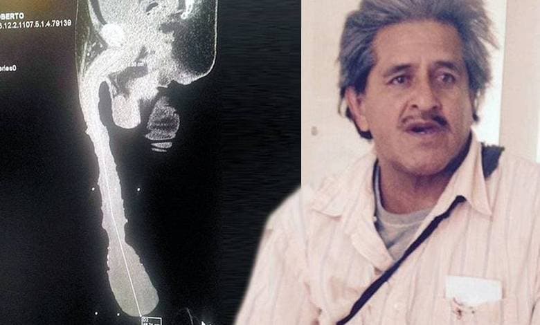Homem com maior pênis do mundo revela que mulheres têm medo de fazer sexo com ele