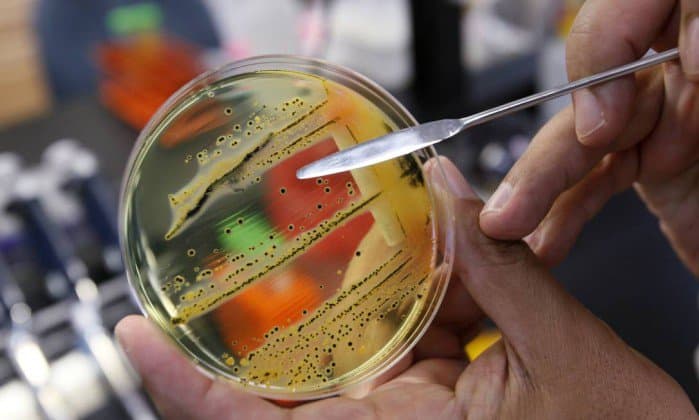 Pesquisador alerta para o risco de infecções por superbactérias no Brasil
