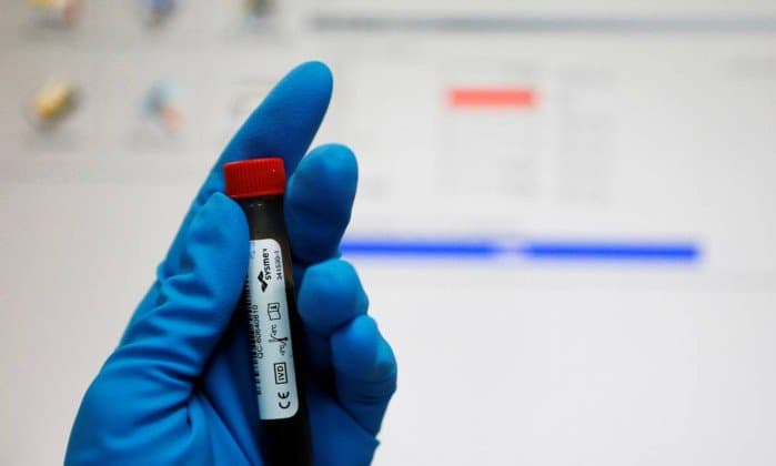 Novo teste de sangue pode detectar presença e localização de tumores