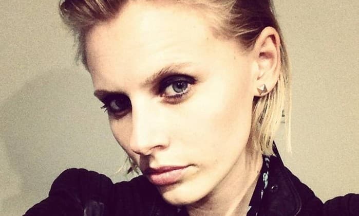 FOTOS: Modelo quase morreu após contrair síndrome rara causada por uso de absorvente