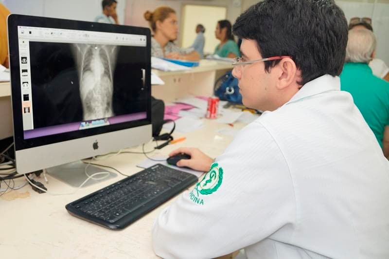 Walfredo Gurgel contará com 18 terminais de visualização de raio X digital